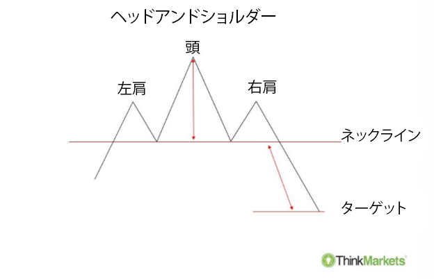 ヘッドアンドショルダー・パターンの構造